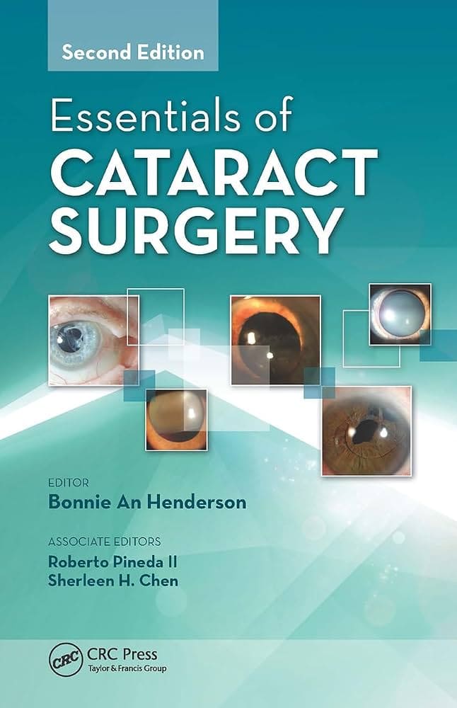 Cataract Surgery Guide